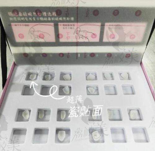 石家庄植美口腔医院牙齿贴面费用2680元起·打造自然闪耀笑容妙招快来Get