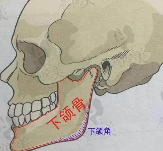 武汉赵贵庆颧骨内推做的自然有效价格