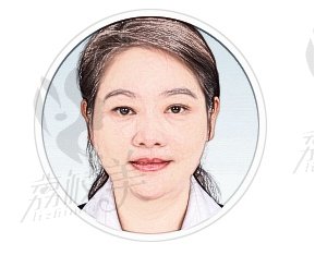 张敏