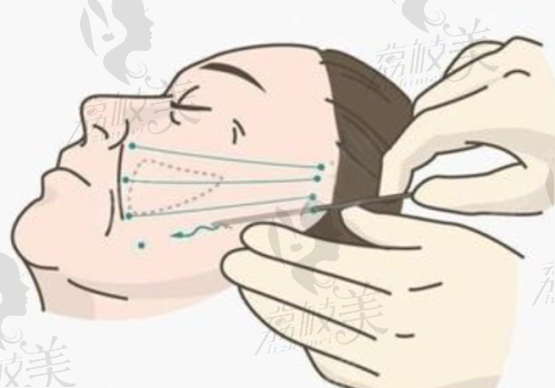 孟强医生怎么预约挂号?