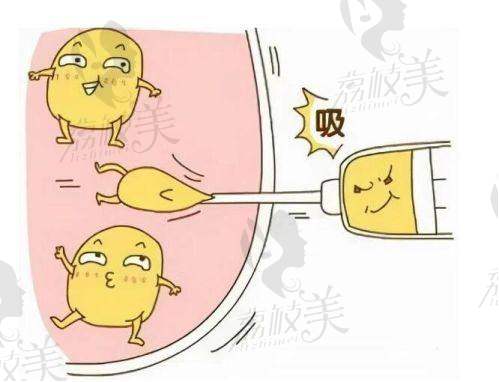 重庆军科疤痕修复中 心洗纹身治疗过程注重细节