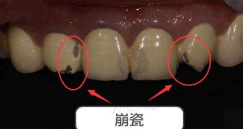 一、河南中医药大学第一附属医院口腔科靠不靠谱？资质讲出来可让你放心！