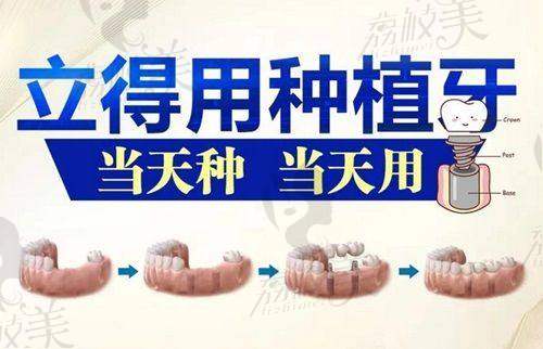 校对小飞机