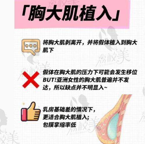丰体针相关知识