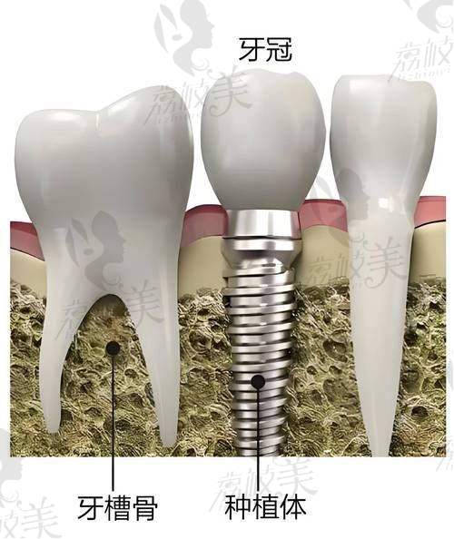 六、尾声总结：为啥说“看牙不如选这里”？