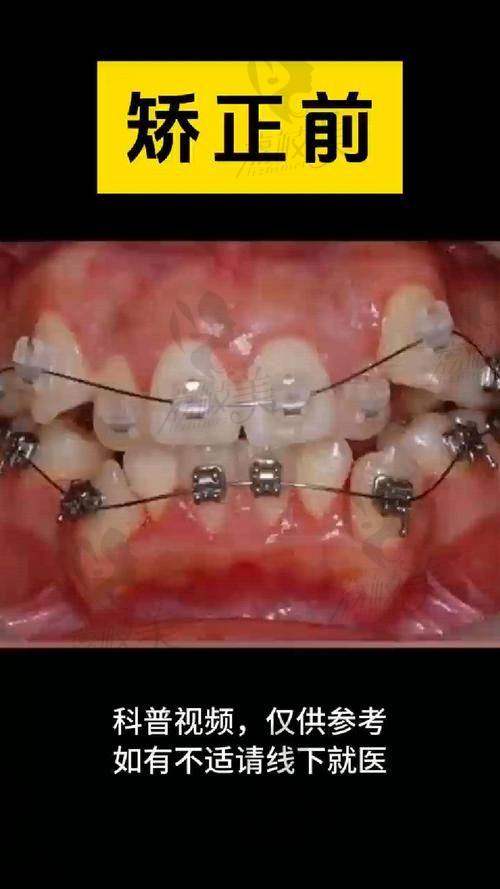 ?结尾防坑Tips：如何选对你的牙科搭子？