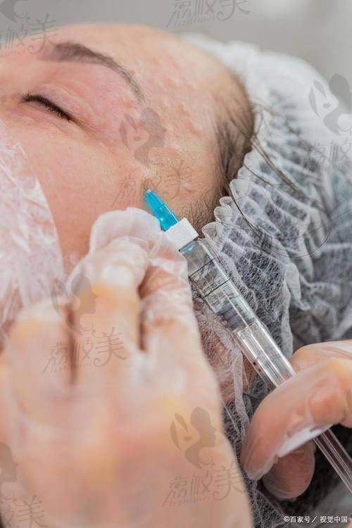 结语:花2000元,精致从下巴开始!