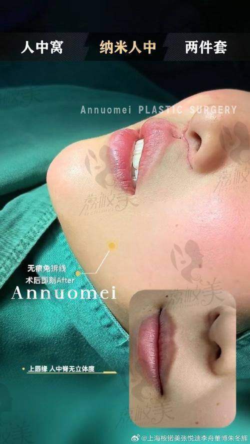 深圳福雅医疗美容医院范开防外人中缩短8800元起，重塑面部比例展现年轻态之美