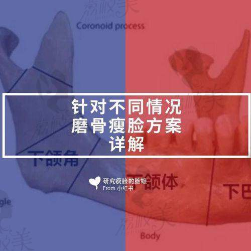 如何预约付国友医生改脸型手术？
