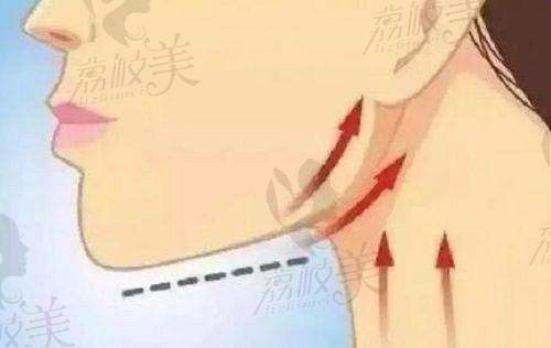 溫州藝星醫(yī)療美容醫(yī)院林文君醫(yī)生怎么樣？揭秘他眼鼻整形、美體塑形專(zhuān)長(zhǎng)及眾多榮譽(yù)！ 