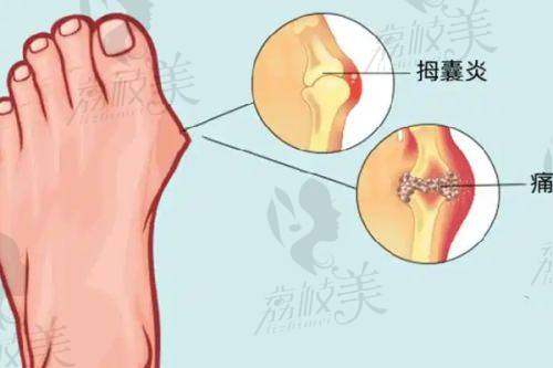 李世荣医生在重庆星荣做男性私密整形超厉害，生殖器延长增粗手术6.8万起别错过！