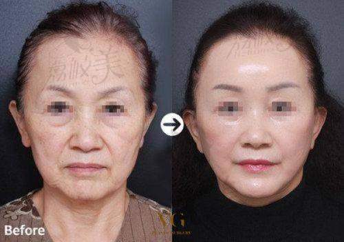 北京凯丽汇美医疗美容诊所地址及乘车路线: