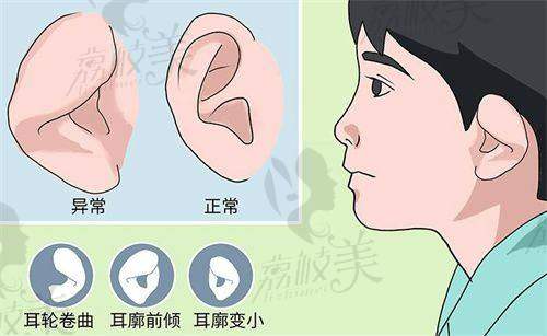四、【男性生殖器延长增粗手术】6.8万起，价格贵吗？值不值？
