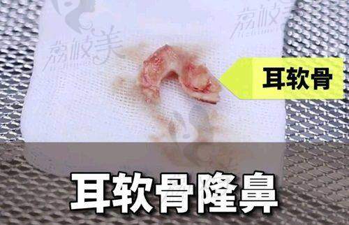 珠海韩妃医疗美容厚唇改薄的医生团队优势