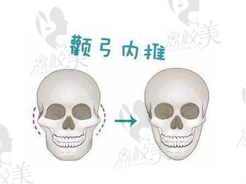 三、哪些人适合尝试重庆星荣李世荣的男性私密整形项目