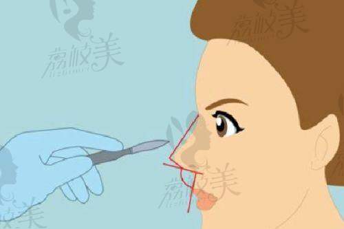 北京凯丽汇美医疗美容诊所价格表: