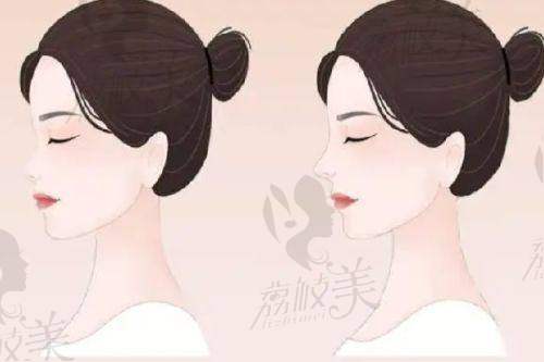 珠海韩妃医疗美容周国伟大腿水动力吸脂的发展前景
