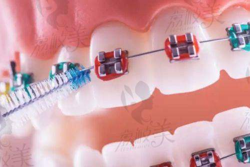 王思宏医生技术特点