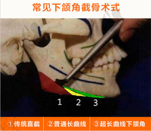 李绍思医生口碑怎么样？