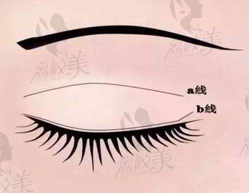 李绍思医生技术特点：