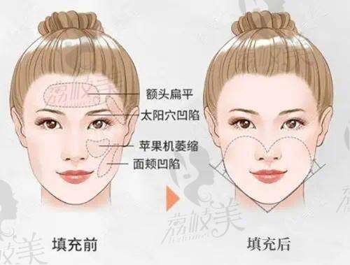 郑州大学第一附属医院皮肤科怎么预约挂号？