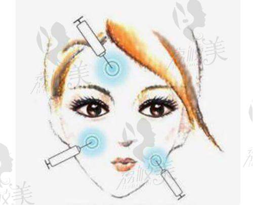 珠海韩妃医疗美容厚唇改薄的成功实例