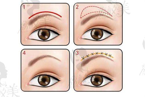 北京凯丽汇美医疗美容诊所怎么样?