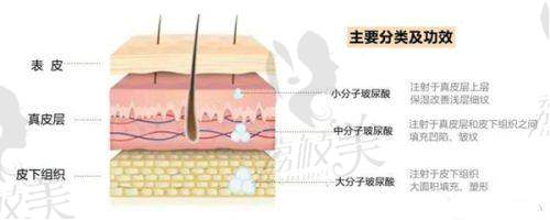 珠海韩妃医疗美容周国伟大腿水动力吸脂与其他项目对比