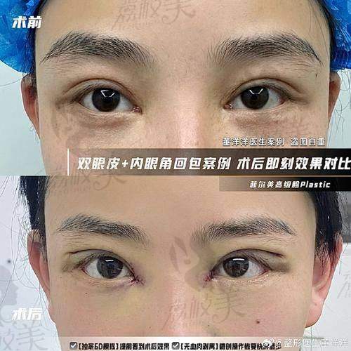 真实实例曝光：他到底有多牛？