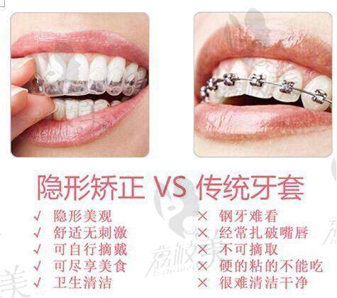 总结：16800元起的隐形矫正，是不是你的理想之选？