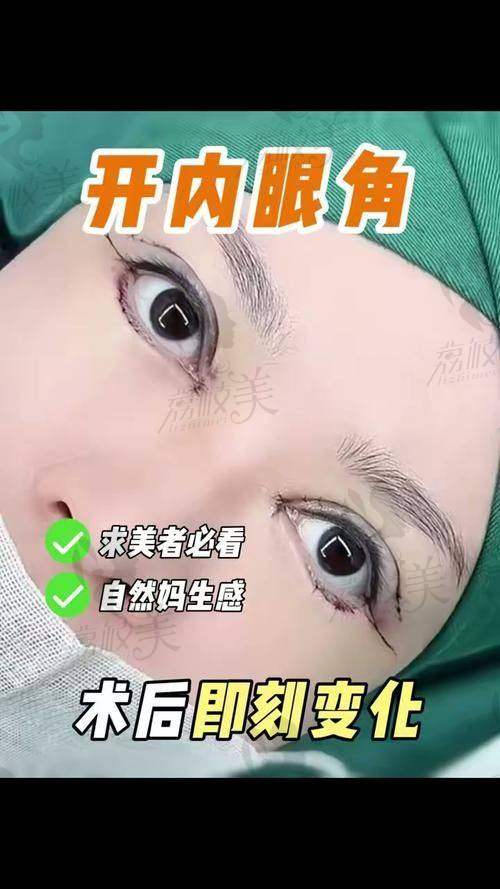 适合人群有哪些?