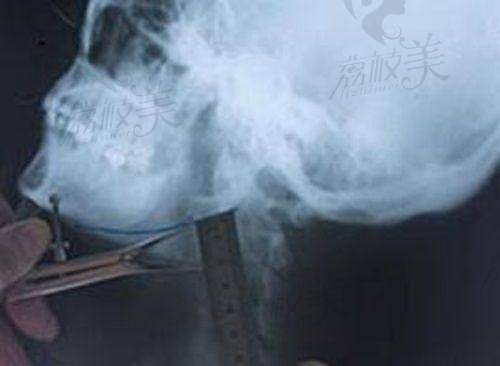 魏鹏医生荣誉资质：
