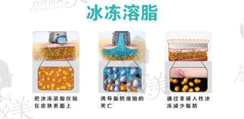 魏鹏医生技术特点：