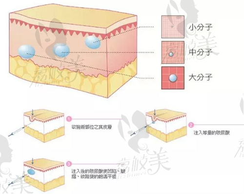 深圳大学总医院整形美容科是正规的吗？