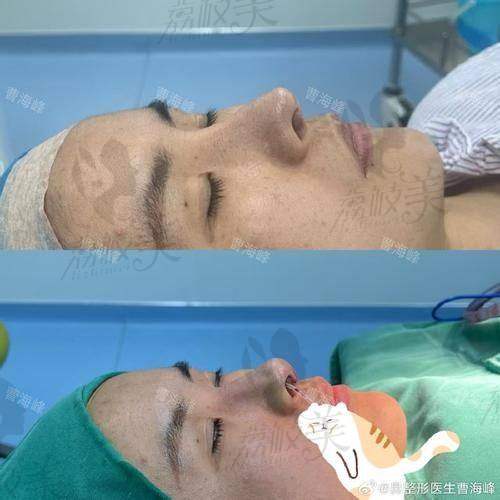 3. 邯鄲現(xiàn)代麗人蔡鵬武院長假體豐胸，不同品牌價(jià)格多樣