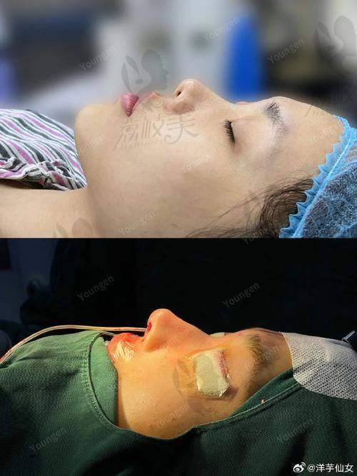 6. 邯鄲現(xiàn)代麗人蔡鵬武院長腹壁整形，3.8 萬起塑造理想腰腹