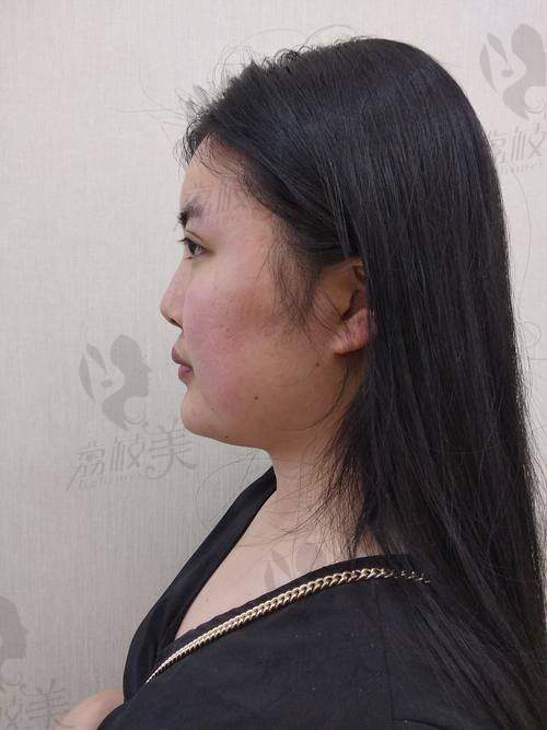 中山贝熙医疗美容医院:口碑爆棚的隆鼻圣地