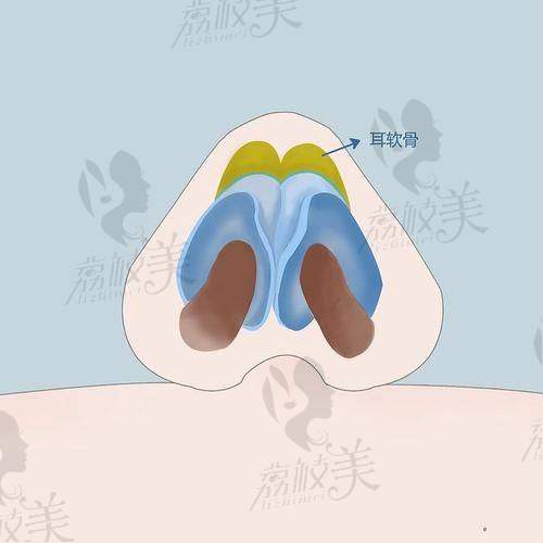 中山贝熙医疗美容医院:劳斯膨体隆鼻的性价比宝藏地