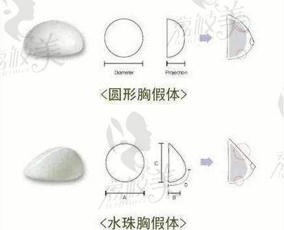 广州齐云香平胸手术费用 20000 元，定制化改善胸型，打造流畅男性化轮廓