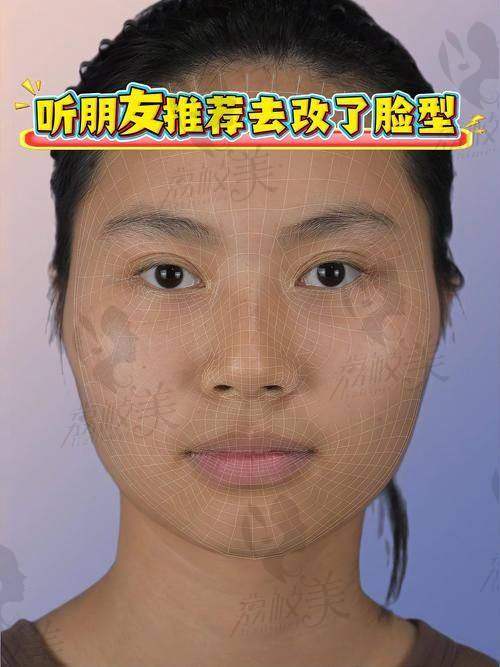 北京樱桃不开刀改脸型能达到怎样的成效？
