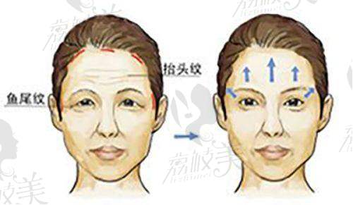 擅長(zhǎng)項(xiàng)目