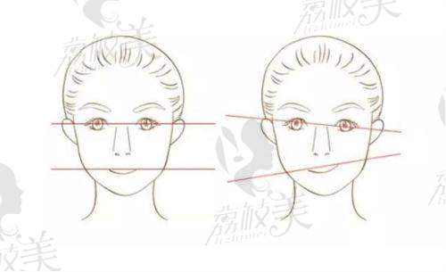 臺(tái)州藝星醫(yī)療美容醫(yī)院去眼袋好嗎？金刀獎(jiǎng)王光建醫(yī)生微創(chuàng)祛眼袋不留痕，顧客體驗(yàn)好評(píng)