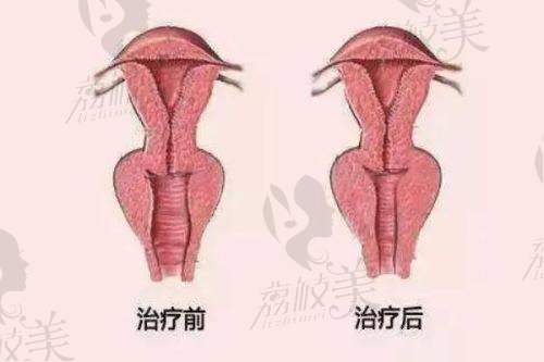 南京美萊整形醫(yī)院是三等甲醫(yī)院?jiǎn)帷t(yī)院價(jià)格參考