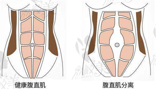 成都華 西醫(yī)院美容科微信與官網(wǎng)預(yù)約流程