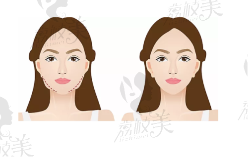 五、上饶丰艺医疗美容门诊部怎么预约：