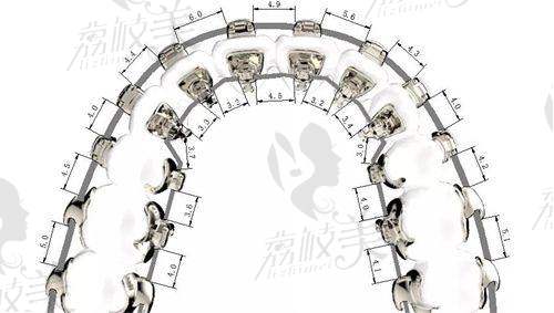 總結：臨夏愛牙口腔診所價格是否值得？