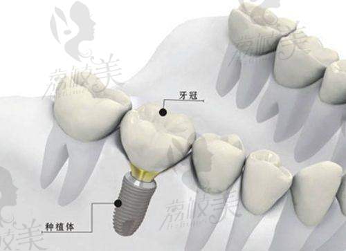 六、總結(jié)回顧——粵口口腔，到底值不值？