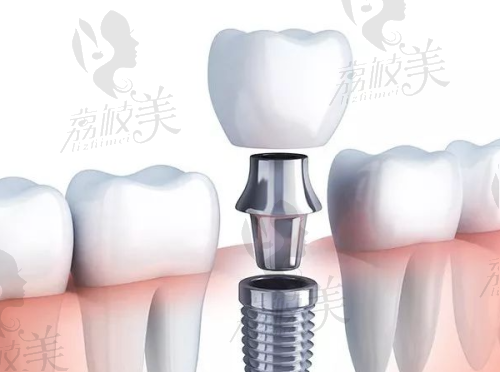 杭州格萊美口腔電話能不能問(wèn)價(jià)格？當(dāng)然能！