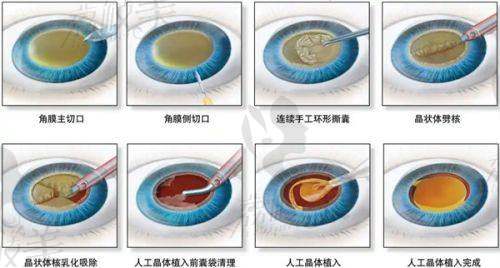 5. 深圳春天阳光医院皮肤抗衰项目价格优势解析