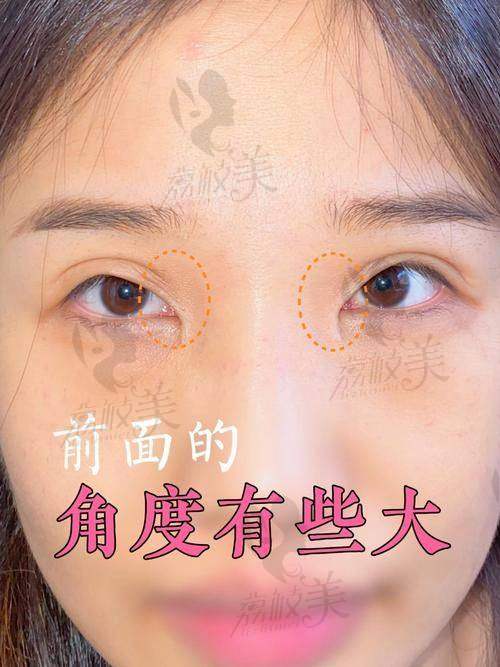 有哪些患者的真實(shí)反饋可以參考？